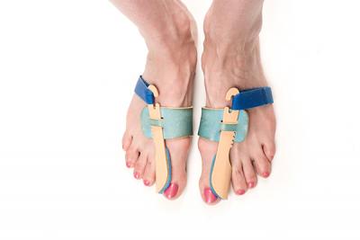 Soins Hallux valgus